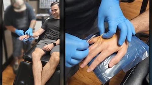 I Got Chipped: Are We Ready for Technology Under Our Skin? still